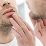 What are the Symptoms of Genital Herpes