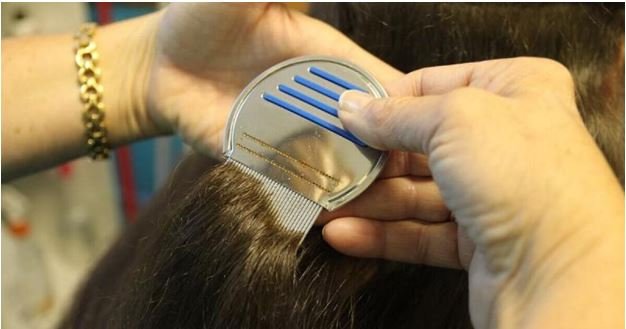 Head Lice