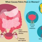 pelvic pain