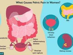 pelvic pain