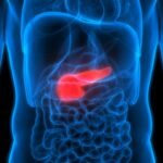 Learn Everything About Chronic Pancreatitis- Its Symptoms, Causes, and Treatment 