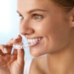 8 Ways to Achieve Great Results with Dental Aligners