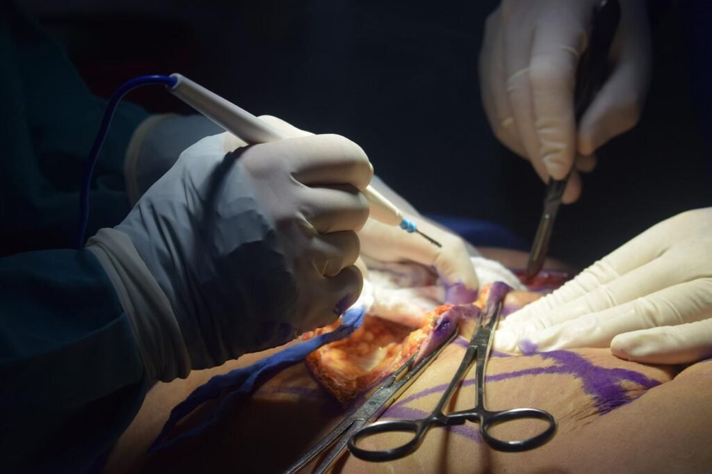 Reduction Mammaplasty: Everything You Need To Know